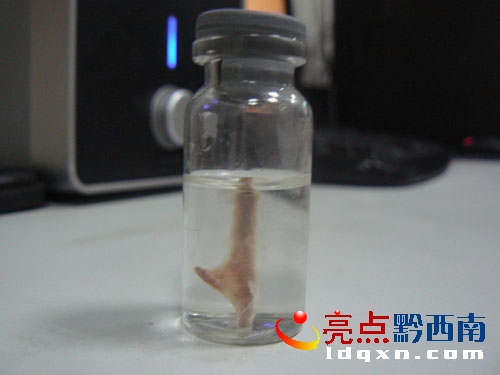 圖為取出的雞骨頭.JPG
